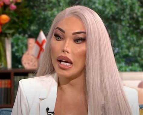 Human Barbie Says Surgery Quest Is Complete After Doctors Warned Nose