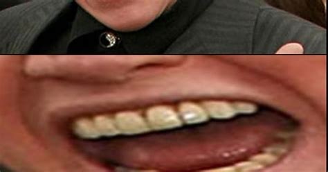 Whats This About Gary Busey S Teeth Imgur