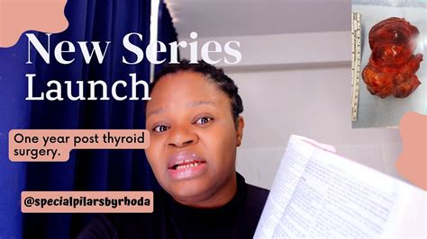 Thyroid Surgery One Year After New Series Launch SPECIAL