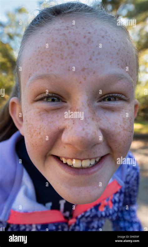 Jb Teen Girls With Freckles Telegraph