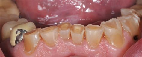 Clínica Dental Lobato Odontología Integral Todas Las Especialidades