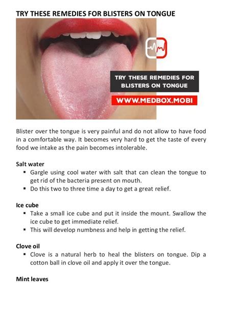 Try These Remedies For Blisters On Tongue