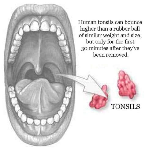 Haff Your Tonsils Can Bounce Higher Than A Rubber Ball Xpost R