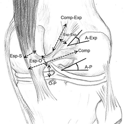 Pdf Oblique Popliteal Ligament An Anatomical Study