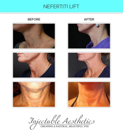 Treatments Injectable Aesthetics