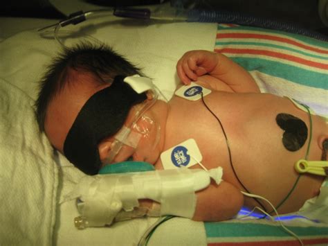 Andrew Spent 2 Weeks In The Nicu Sick Baby Nicu Preemie