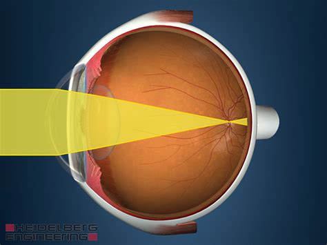 Vision Impairment Myopia Hyperopia Presbyopia Know The Eye