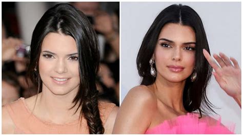 Kendall Jenners Before And After Transformation How She Has Changed