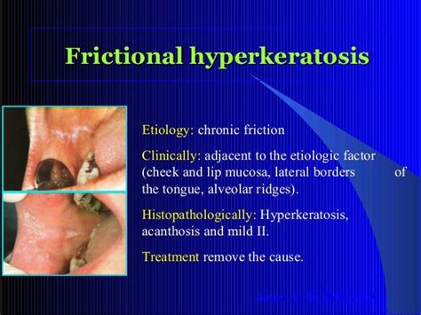 White Lesions