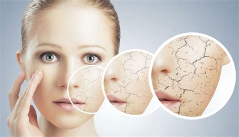 Dry Skin On Face Causes And Treatment