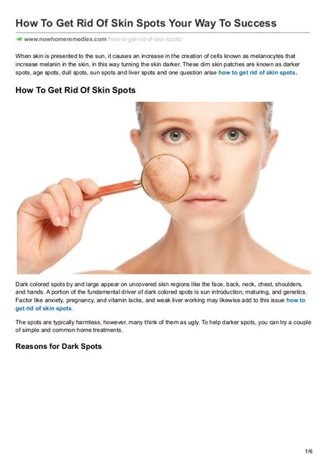 How To Get Rid Of Skin Spots Your Way To Success Now Home Remedies