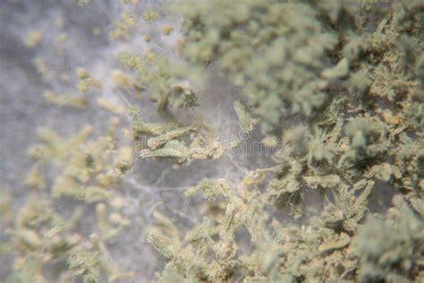 Aspergillus Oryzae Is A Filamentous Fungus Under The Microscope In
