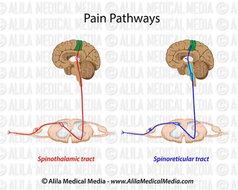 Alila Medical Media Pain Pathways Narrated Animation Medical Animation