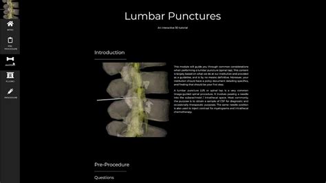 Lumbar Puncture Highlights Youtube