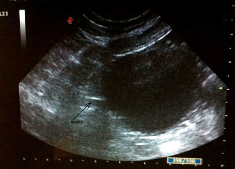 Cystocentesis Ultrasound Guided Ultrasound In Dogs Canis Vetlexicon