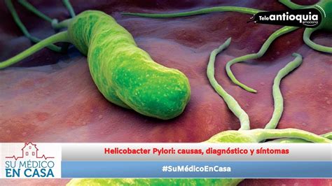 Sumédicoencasa Helicobacter Pylori Causas Diagnóstico Y Tratamiento