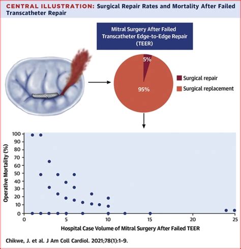 Mitral Surgery After Transcatheter Edge To Edge Repair Society Of