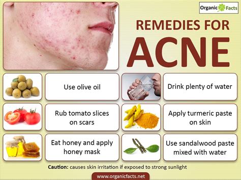 Home Remedies For Acne Scars Include Sandalwood Ice Tomato Cucumber