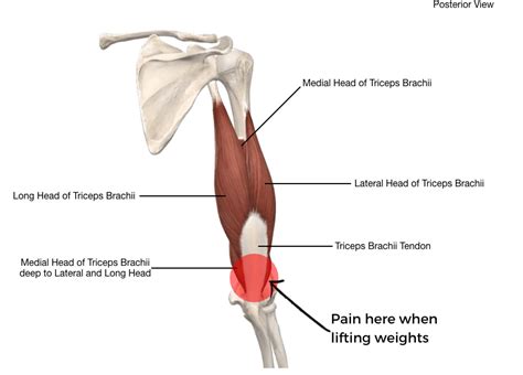 Triceps Tendonitis Lifters Elbow Pain A Helpful Guide 2023