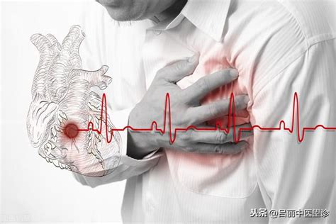 中醫對心臟病的認識與治療 每日頭條