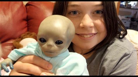 Alien Head Baby A Newborn With An Unusually Large Head Was Rescued By