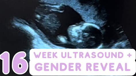 16 Week Ultrasound Gender Reveal Fet 2 Embryo Adoption Embryo Donation Ivf Journey