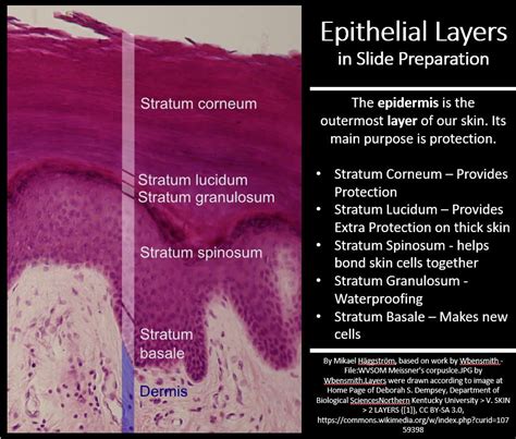 Describe The Layers Of Epidermis In A Thick Skinned Area