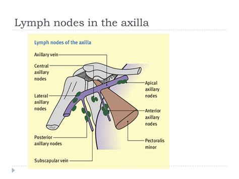 What Cause Lymph Nodes In The Neck Swollen Lymph Nodes Information