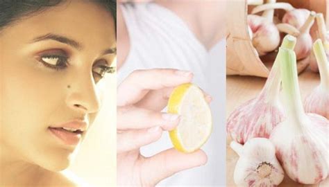8 easy home remedies for quick removal of skin tags