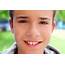 Boy Teenager Closeup Face Macro Happy Smiling Stock Photo  Image Of