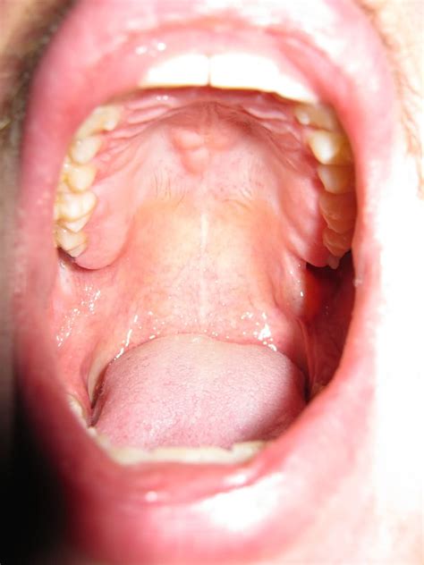The Inside Of A Mouth Streaming Squirt