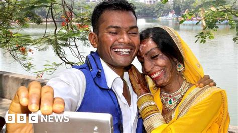 Indian Acid Attack Bride Finds Love From A Wrong Number Bbc News
