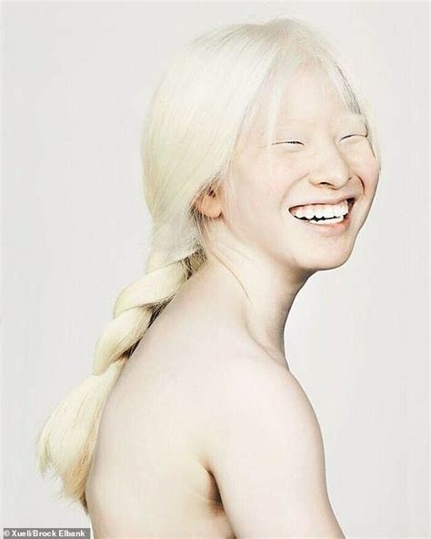 Albino Model Who Was Abandoned As A Baby In China Features In Vogue