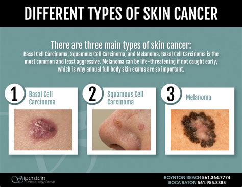 Info Skins Cancer Most Common Type Of Skin Cancer That You Should Know
