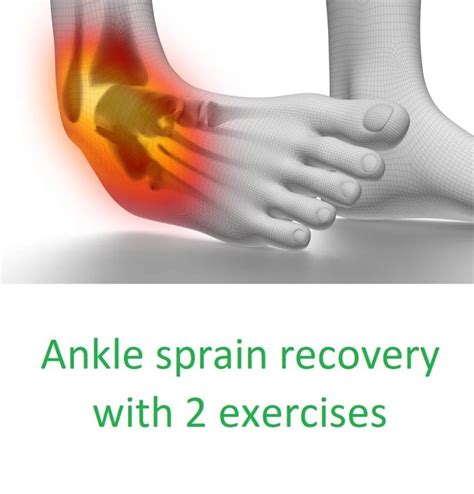 Sprained Ankle Cause Symptoms And Treatment With Exercises