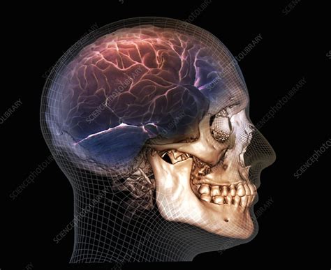 Human Skull And Brain 3d Ct Scan Stock Image C0371620 Science