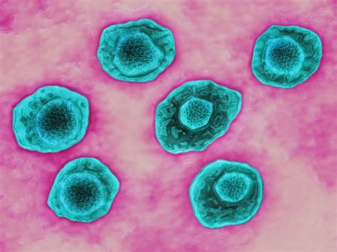 Virus particles in cultured lymphoblasts from burkitt's. Epstein-Barr Virus Raises Risk of 7 Autoimmune Diseases