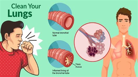 Get Rid Of Phlegm And Mucus In Chest And Throat Instantly Health Cares