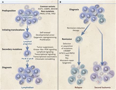 Pathophysiology Of Acute Lymphocytic Leukemia