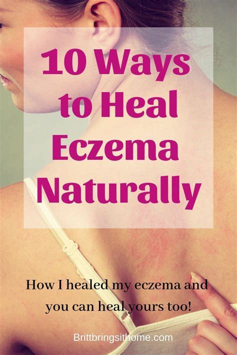 How To Heal Eczema Naturally Natural Eczema Remedies Eczema Remedies