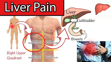 Liver Pain Right Upper Abdominal Pain Right Upper Quadrant Pain