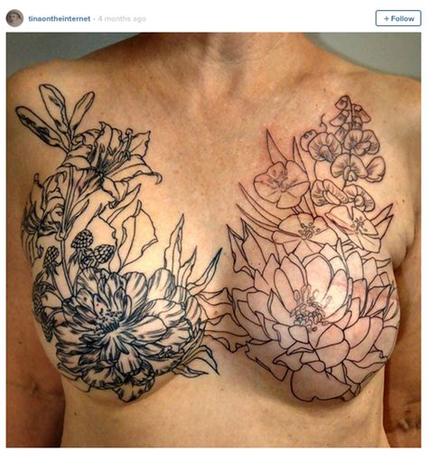 Post Mastectomy Tattoos Are Much More Than Body Art Smooth