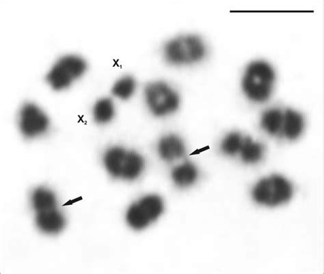 Male Metaphase I Of Latrodectus Sp Showing 12ii X 1 X 2 The Download Scientific Diagram