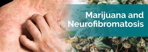 Neurofibromatosis is an inherited disorder of the nervous system in which tumors develop on nerves, leading to a range of complications. Medical Marijuana for Neurofibromatosis - Marijuana Doctors