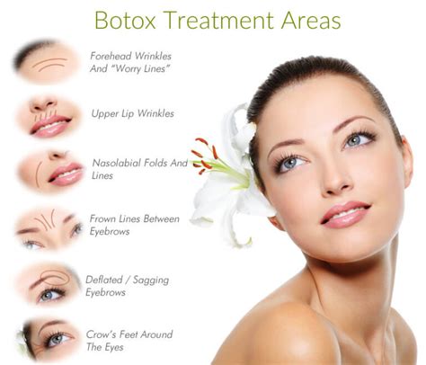 What Areas Can Botox Treat Edm Chicago