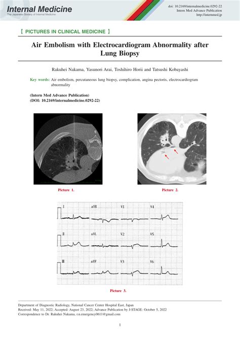 Pdf Air Embolism With Electrocardiogram Abnormality After Lung Biopsy