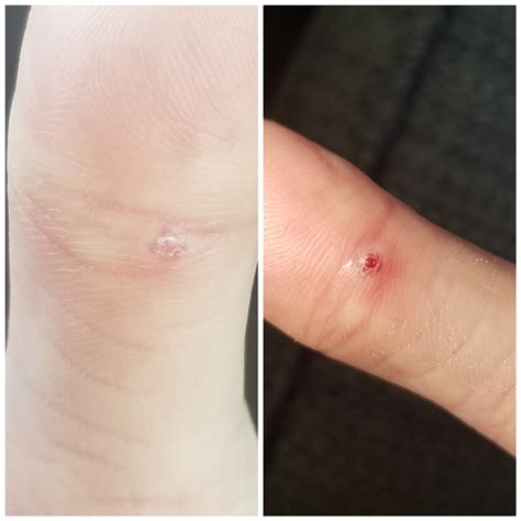 Left Was First Day I Noticed It And Today Is 11days Later Its Super