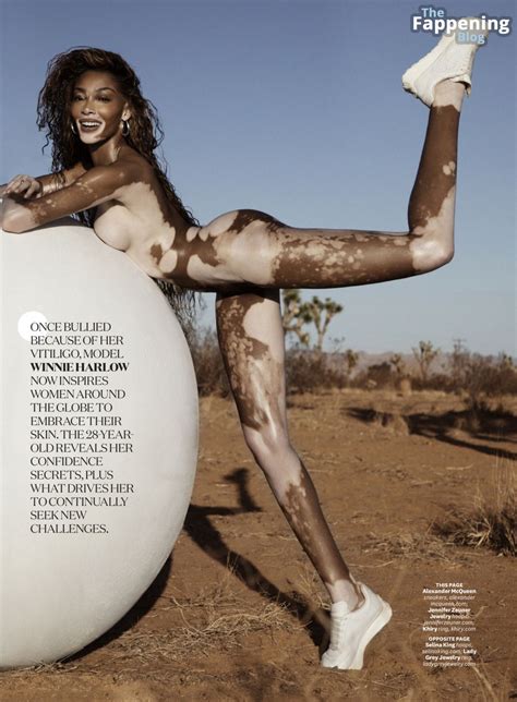 Winnie Harlow Winnieharlow Nude Leaks Photo 1118 Thefappening