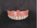 Photos of False Teeth Bottom Plate