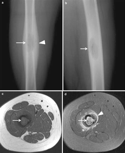 Mri Characteristics Oncohema Key